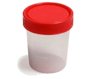 [0322] Frasco Muestras 120 cc. estéril